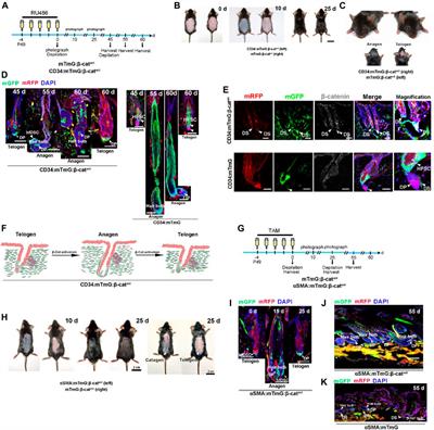 β-Catenin Signaling Evokes Hair Follicle Senescence by Accelerating the Differentiation of Hair Follicle Mesenchymal Progenitors